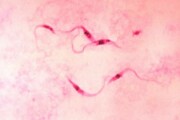 Trypanosoma_cruzi_crithidia